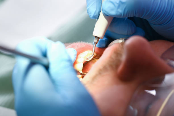 Best Emergency Dental Services for Seniors in Wayne, OH